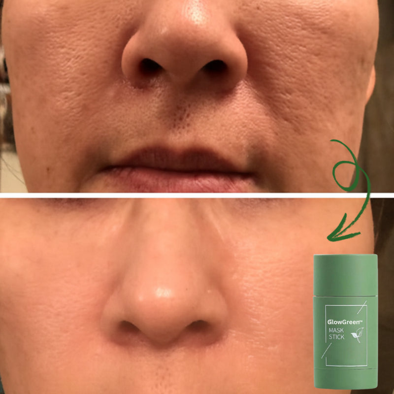 Product feature image