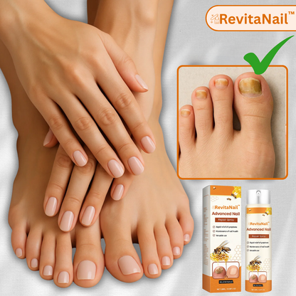 Revitanail™ – Grey Nail Treatment Spray