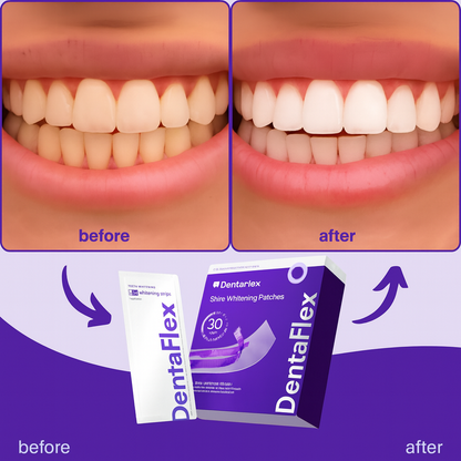 DentaFlex™ Teeth Whitening Strips – 95% valkoisemmat hampaat 30 minuutissa